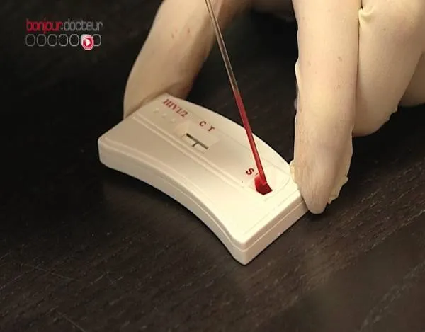 Pháp cho phép lưu hành sản phẩm tự xét nghiệm HIV từ năm 2014